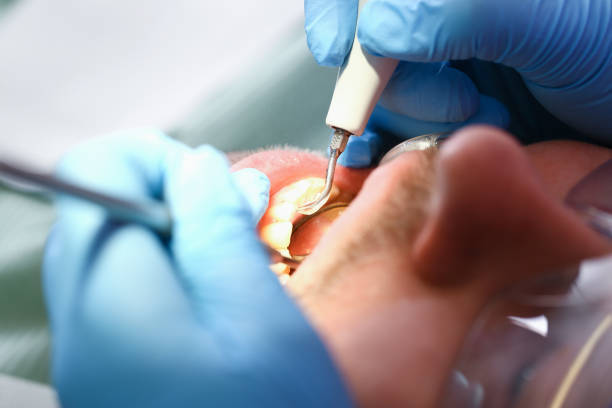 Best Holiday Emergency Dentist in South Charleston, WV