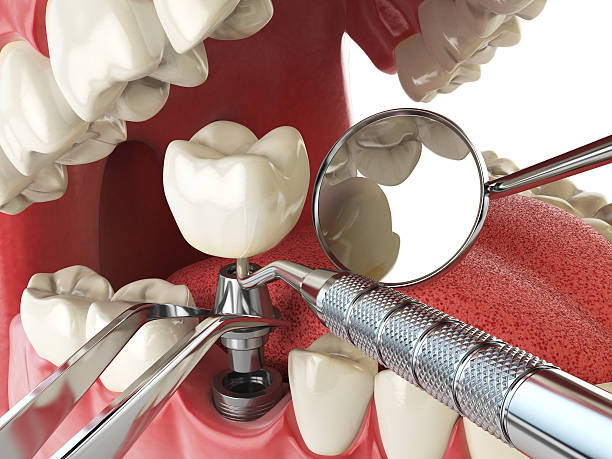 Best Mobile Emergency Dentist in South Charleston, WV
