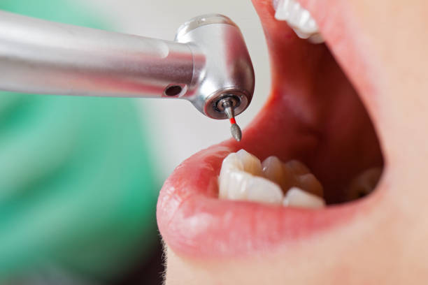 Best Orthodontic Emergency Dentist in South Charleston, WV